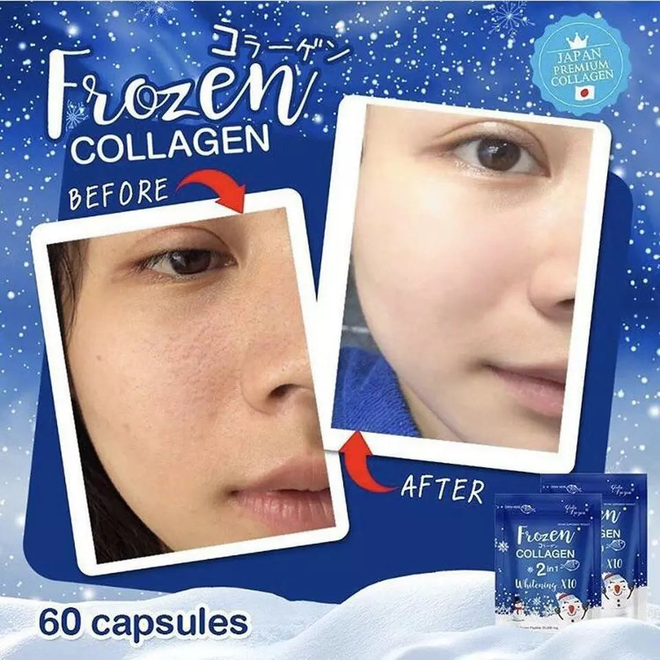 Frozen Collagen 2-in-1 Whitening x10 β 60 Capsules ( Pack of 2 ) ββ¨