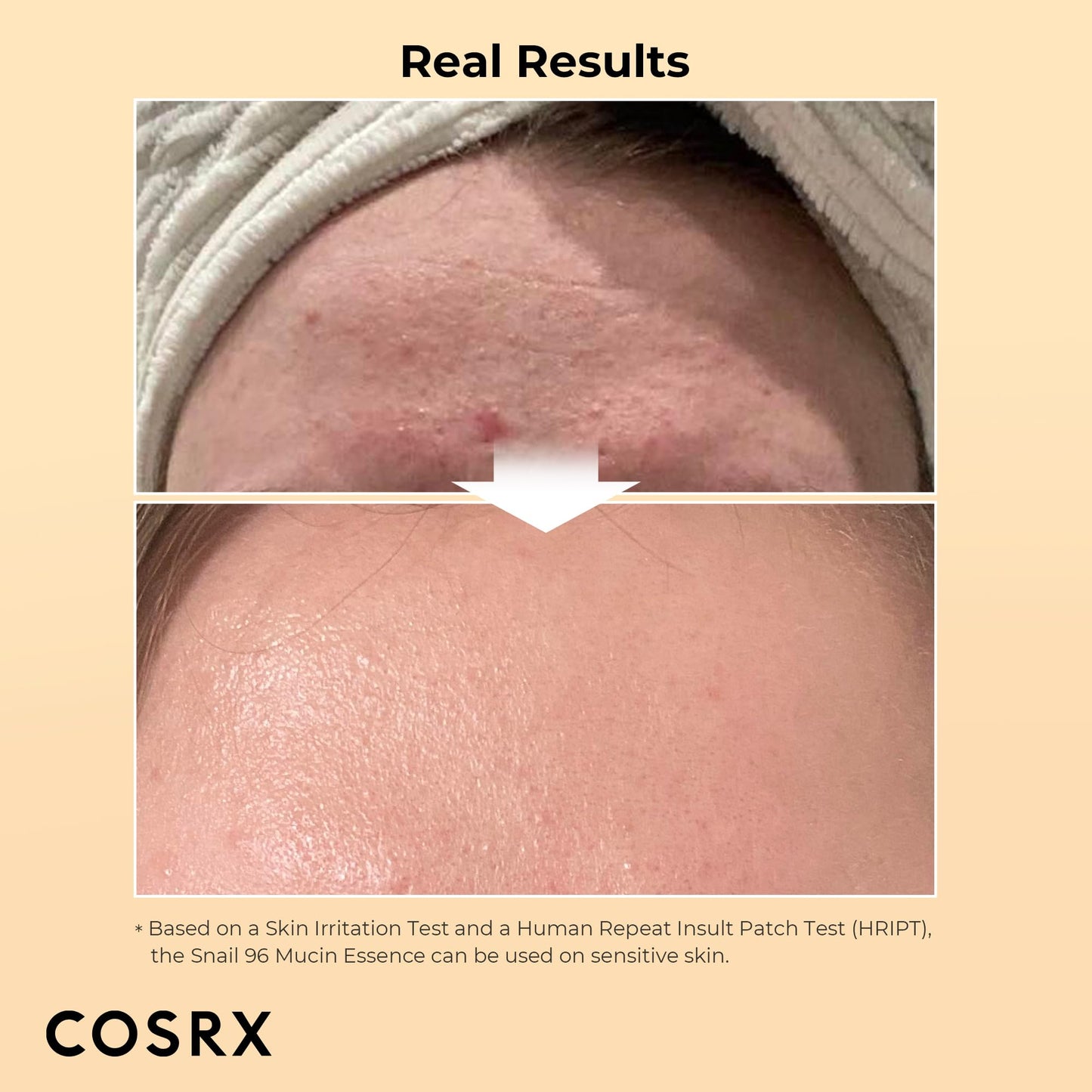 COSRX Advanced Snail 96 Mucin Power Essence (100ml) – Made in Korea
